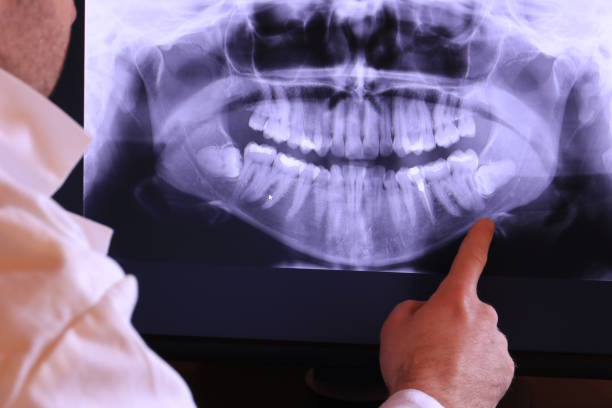 Best Broken or Chipped Tooth Repair in Dormont, PA